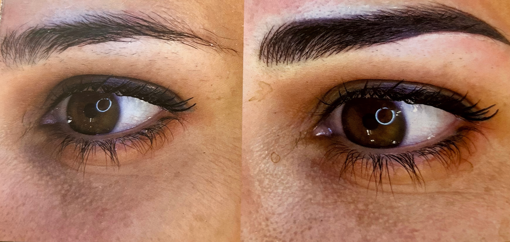 Avant et Après traitement de dermopigmentation